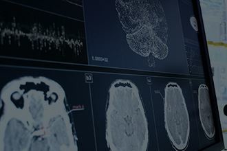 Traumatic Brain Injury Image